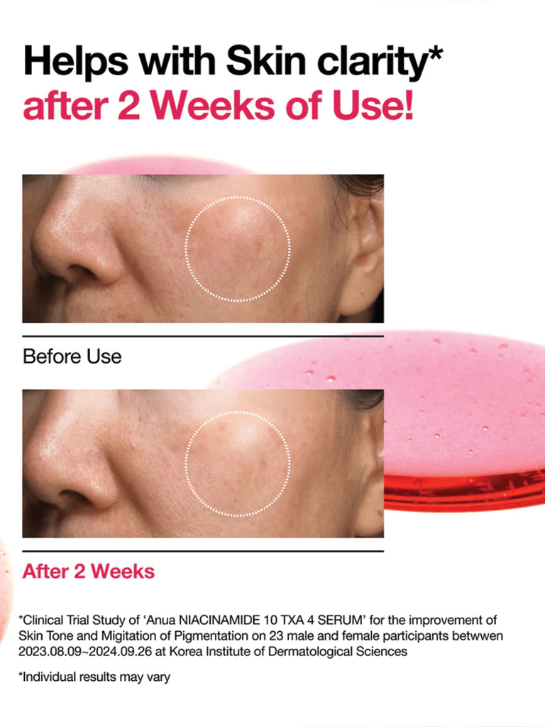 Anua NIACINAMIDE 10%+TXA 4% Serum