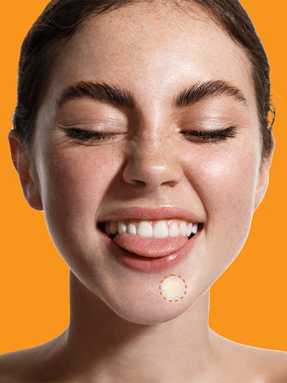 NOLAHOUR Spot Eraser 3 Steps (Acne Patch) 84 Patches