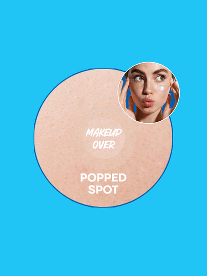 NOLAHOUR Spot Eraser Blue (Acne Patch) 63 Patches