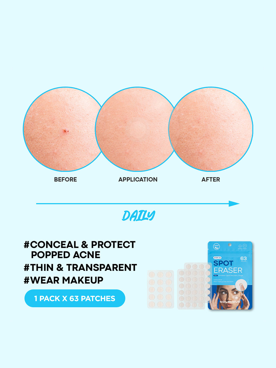 NOLAHOUR Spot Eraser Blue (Acne Patch) 63 Patches
