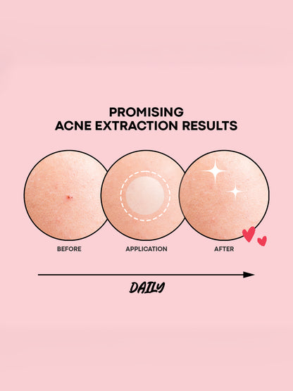 NOLAHOUR CLEAR SPOT PATCH 26 PATCHES