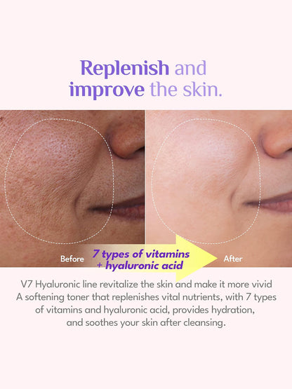 It's Skin V7 Hyaluronic Toner 150 ML