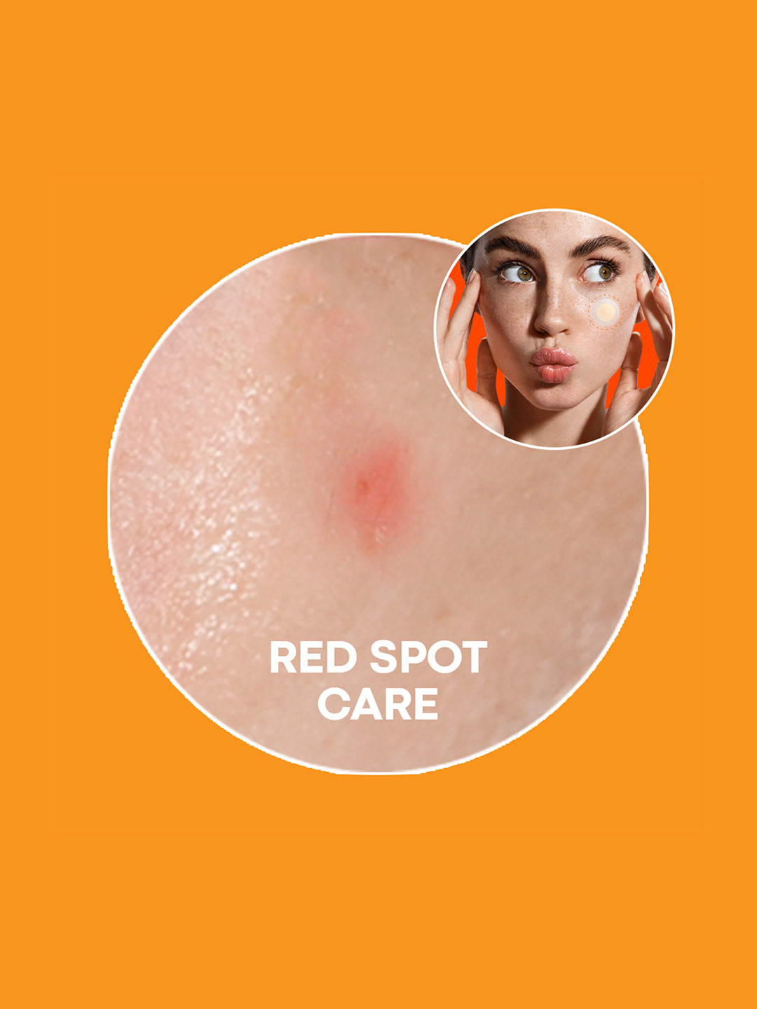 NOLAHOUR Spot Eraser Orange (Microneedle Acne Patch) 12 Patches