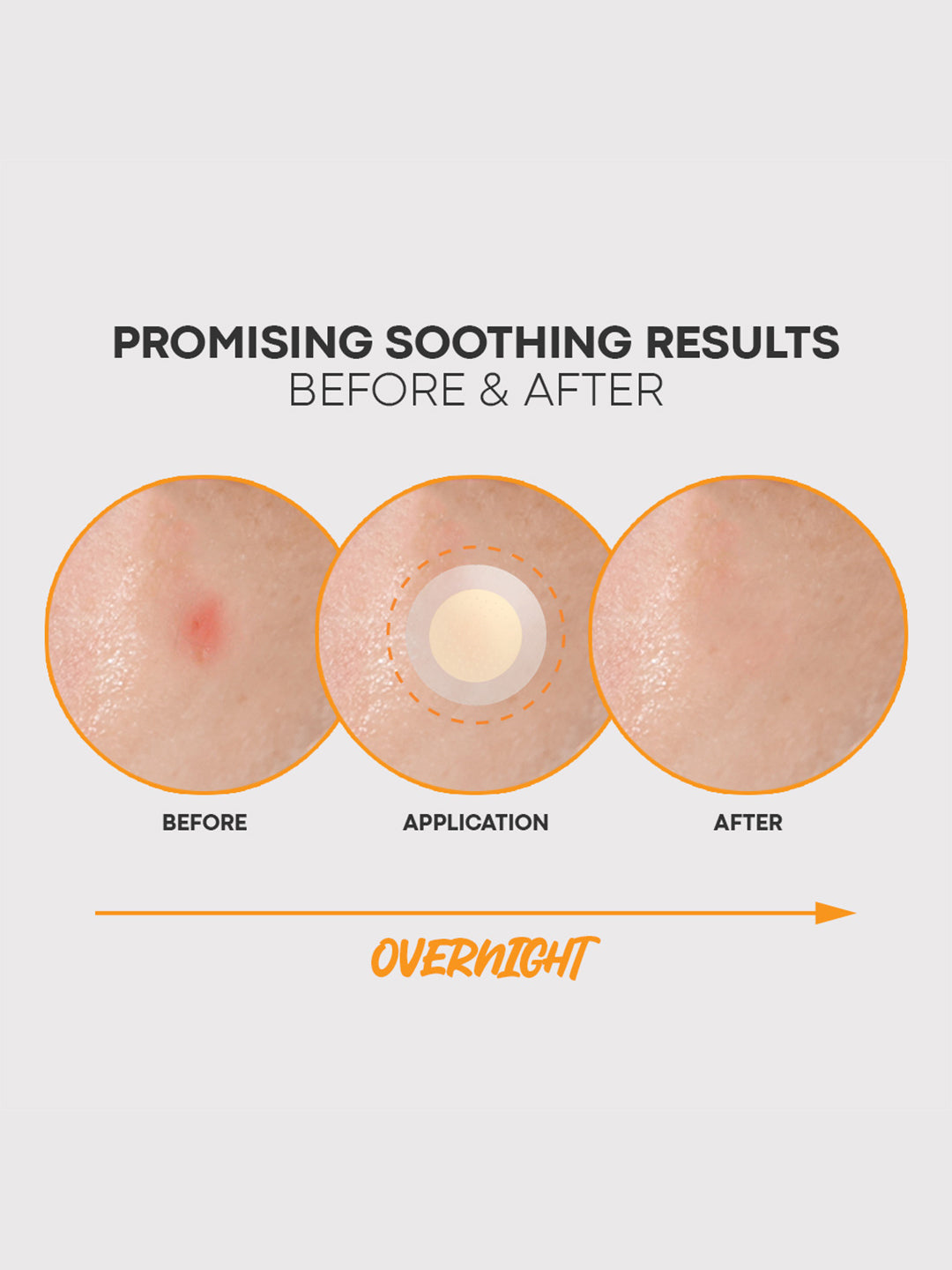 NOLAHOUR Spot Eraser Orange (Microneedle Acne Patch) 12 Patches