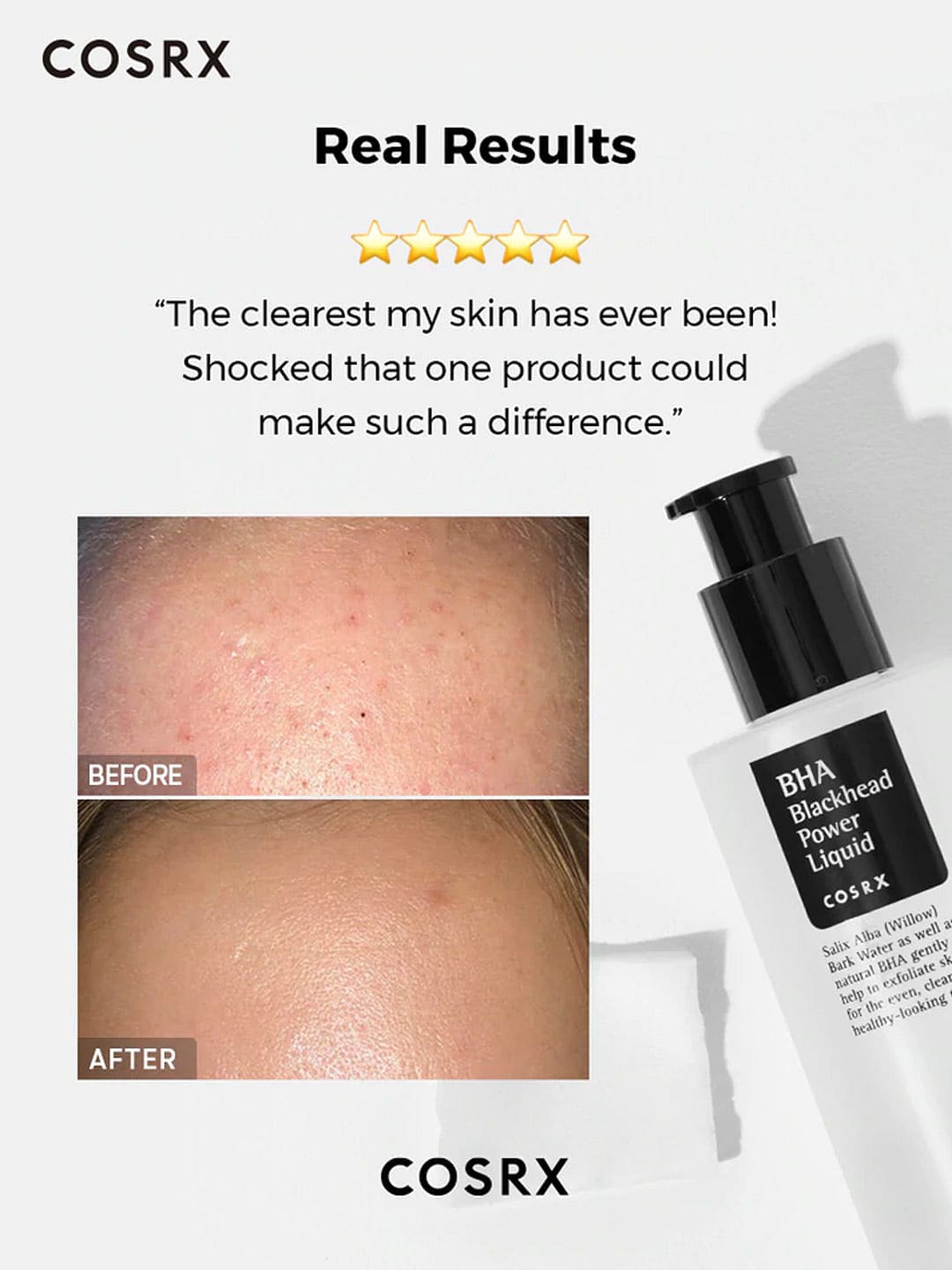 COSRX BHA Blackhead Power Liquid 100 ml