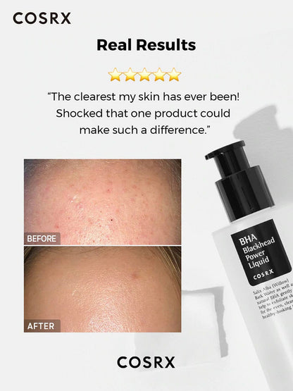 COSRX BHA Blackhead Power Liquid 100 ml